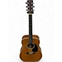 Vintage 1981 Martin HD28 Natural Acoustic Electric Guitar Natural